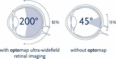 Optos Imaging